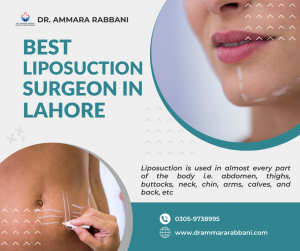 Liposuction