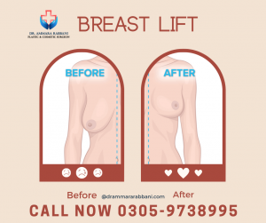 Female Breast Lift Surgery in Lahore
