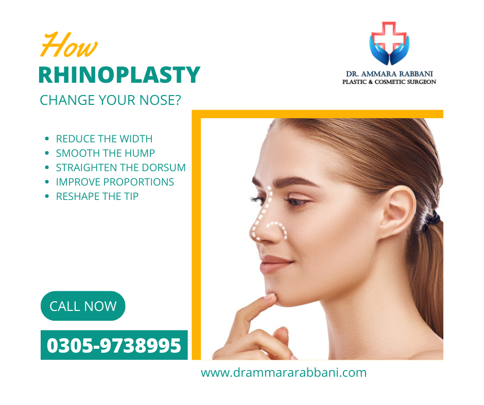 Nonsurgical Rhinoplasty