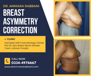 Breast Asymmetry Correction