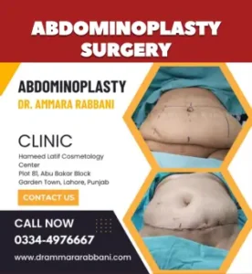 ABDOMINOPLASTY
