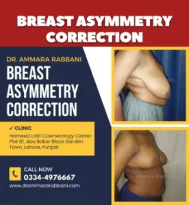 Breast Asymmetry Correction surgery