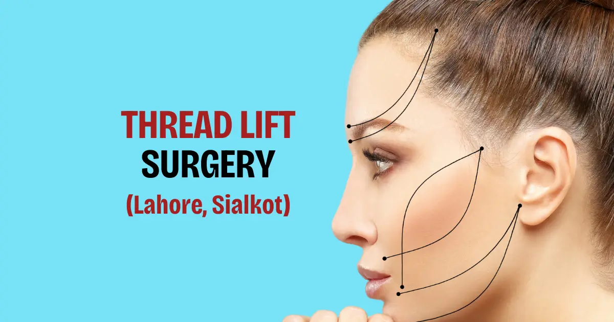 Thread Lift In Sialkot