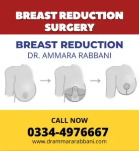breast reduction surgery