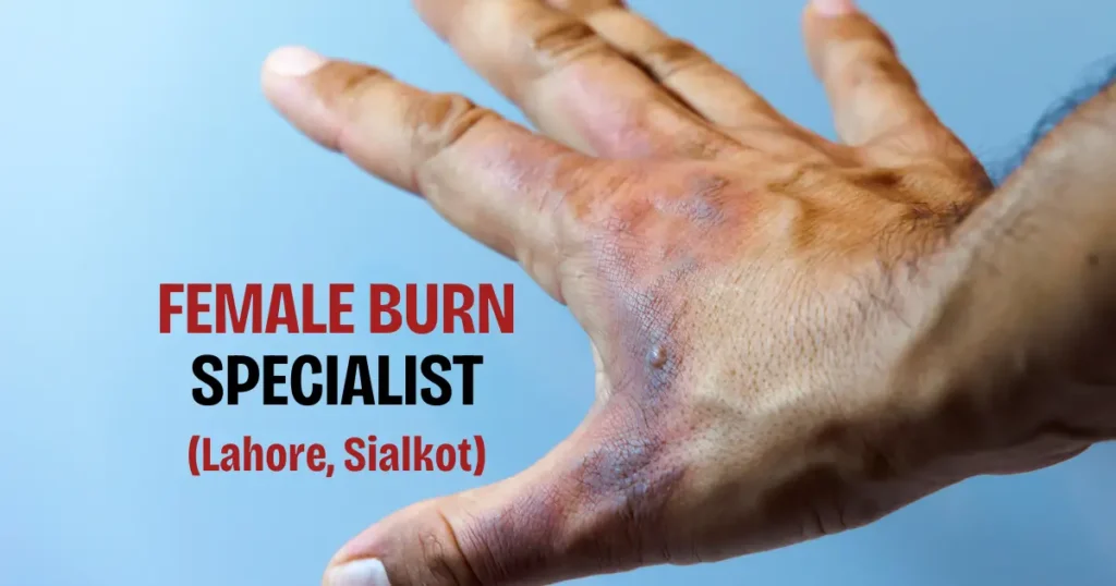 Burn Specialist in Sialkot