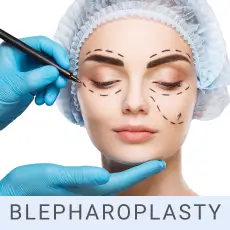 blepharoplasty surgery in sialkot