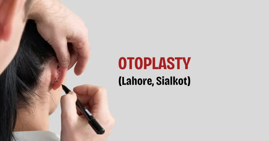 Otoplasty in Sialkot