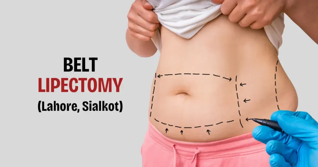 belt lipectomy in Sialkot