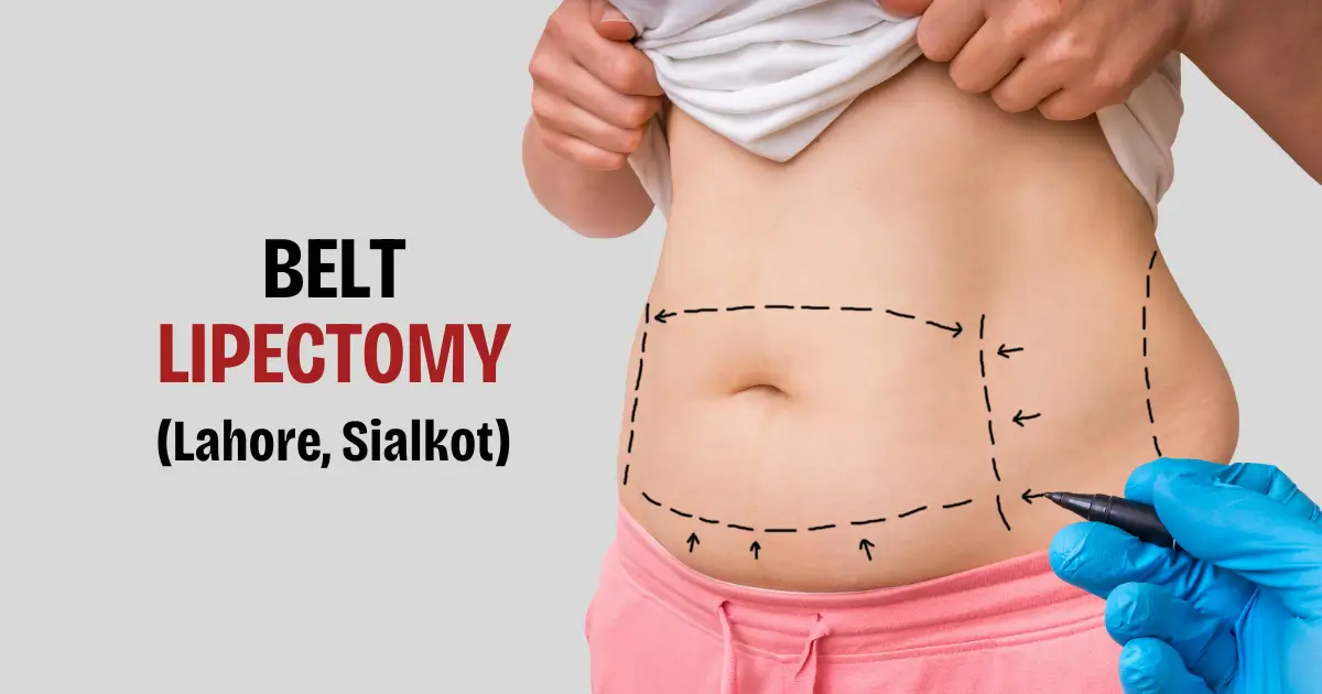belt lipectomy in Sialkot