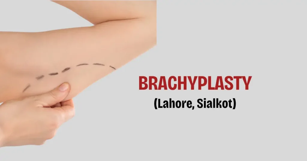 brachyplasty in Sialkot
