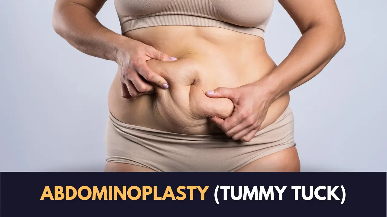 Abdominoplasty Near Me