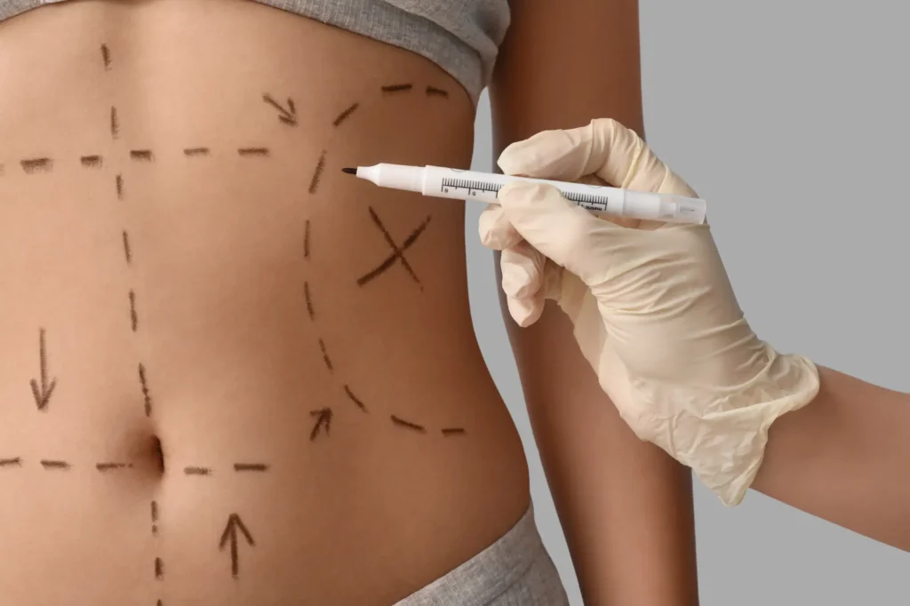 Female plastic surgeon Lahore