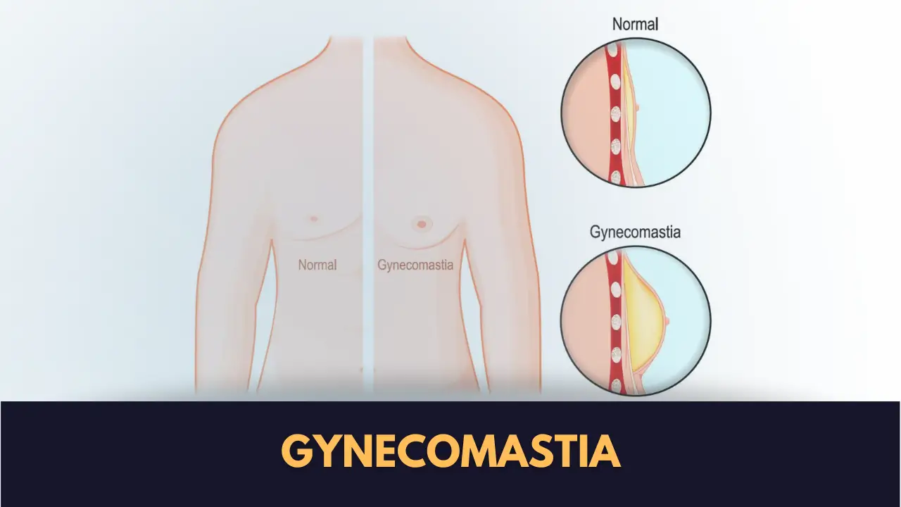 Gynecomastia Surgery Near Me