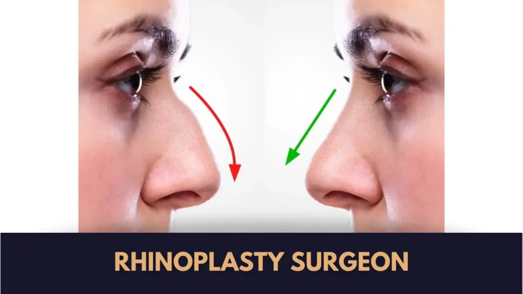 best rhinoplasty surgeon