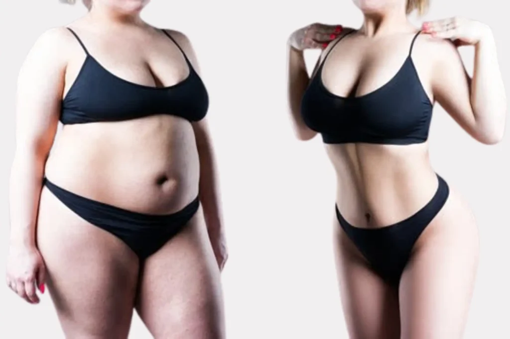 Top Mommy Makeover Doctor Lahore