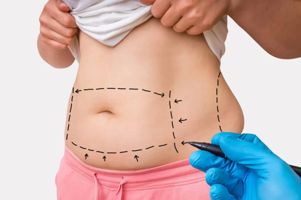 Best Mommy Makeover Surgeon