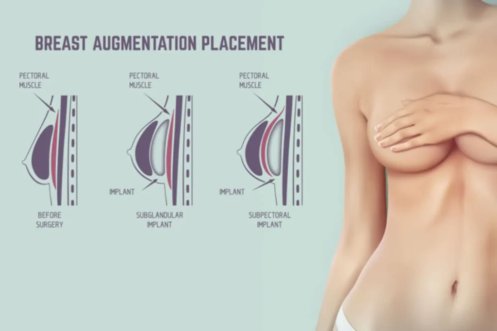 breast augmentation johar town