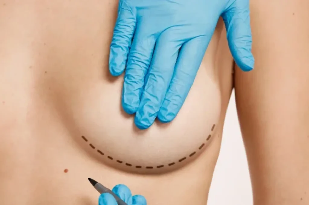 breast reduction near me