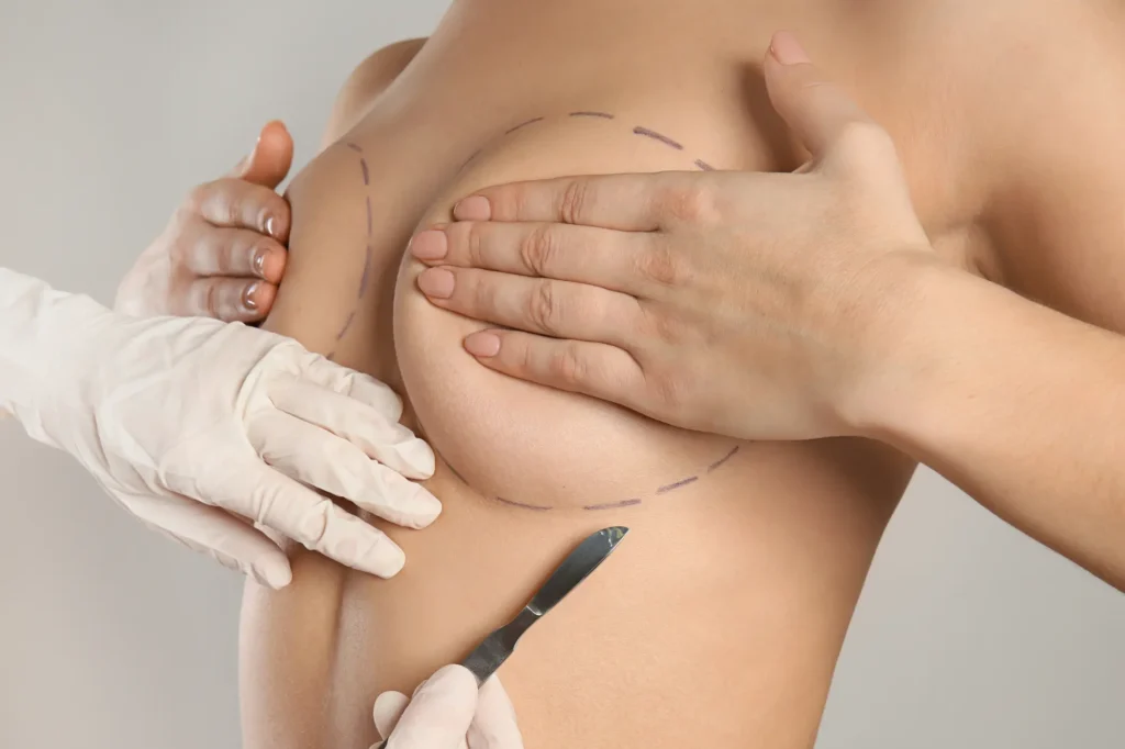 breast reduction surgery cost