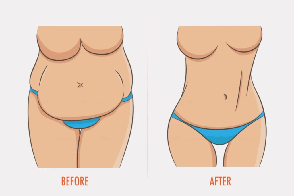 Mommy Makeover Cost Pakistan