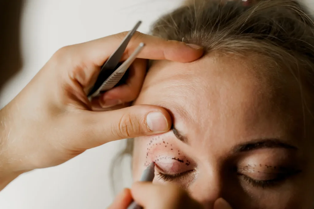 Eyelid Surgery in Lahore