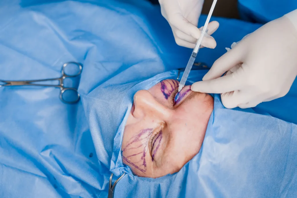 blepharoplasty Pakistan