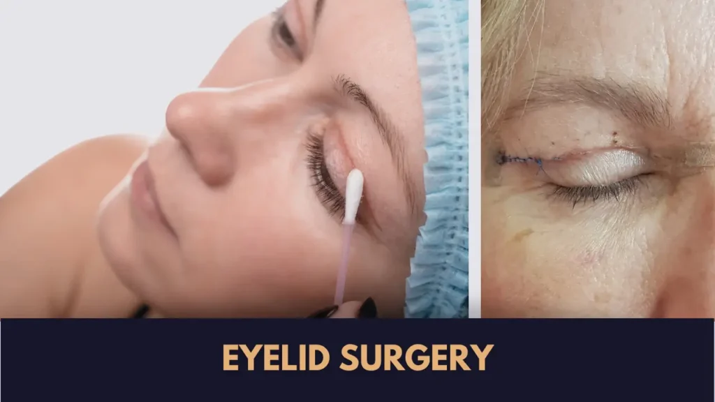blepharoplasty in Lahore