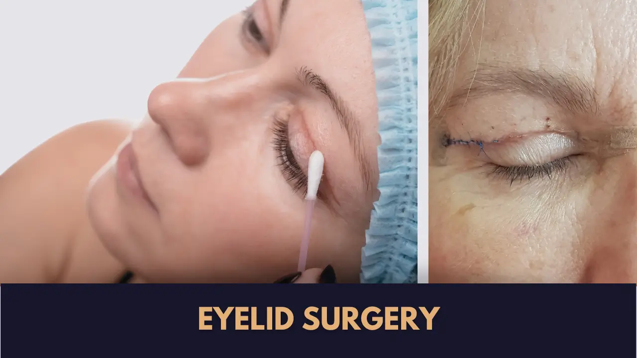 blepharoplasty in Lahore