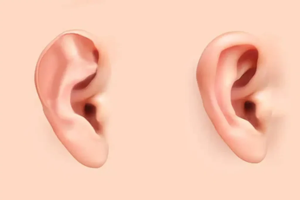 ear reshaping in sialkot