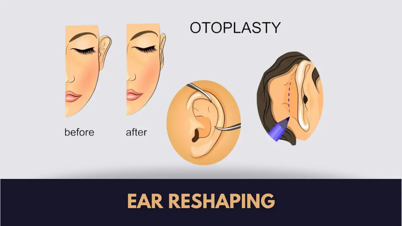 ear reshaping surgery in lahore