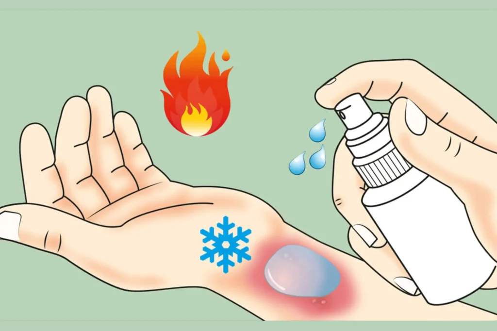 burn treatment in Lahore