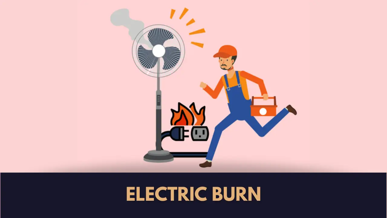 low voltage electric burns Lahore