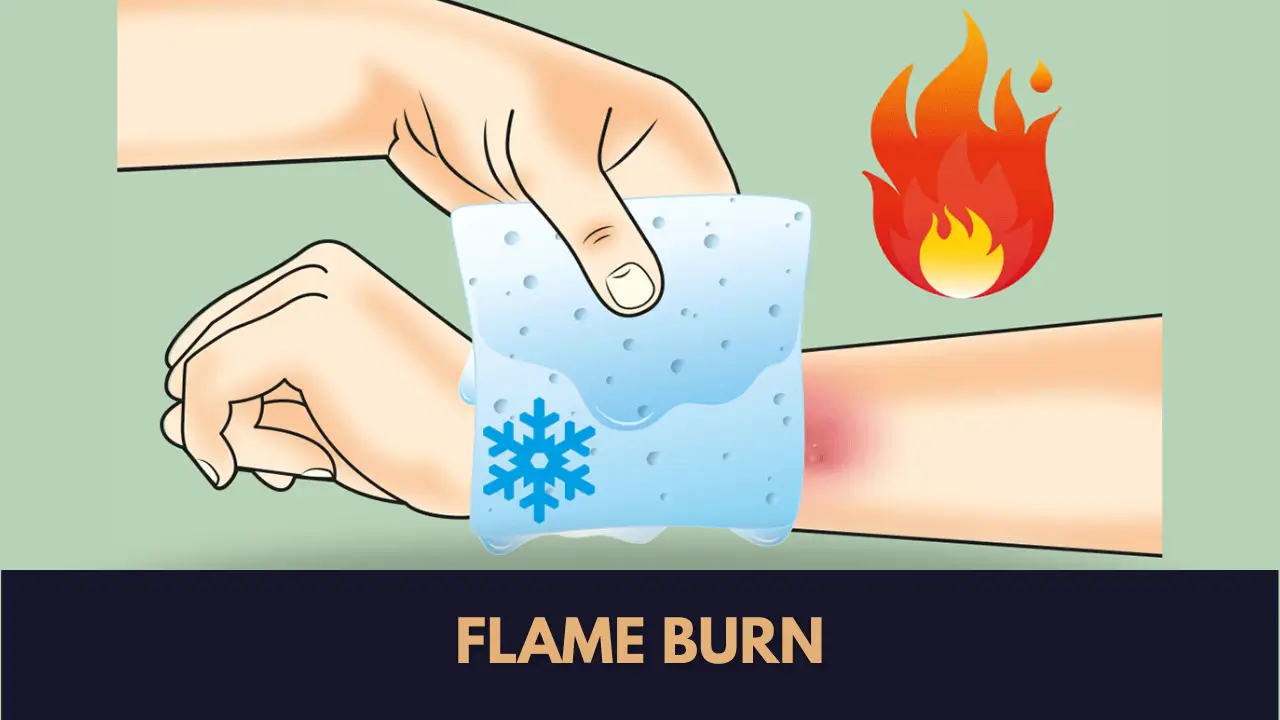 reconstructive burn surgery Lahore