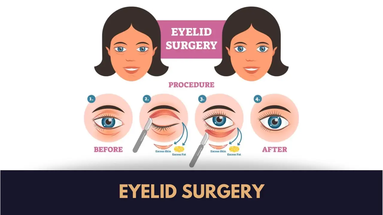 blepharoplasty in Pakistan