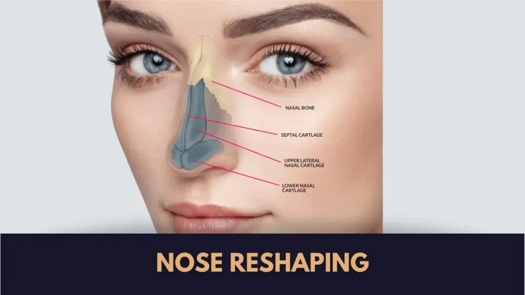 nose job surgery in lahore