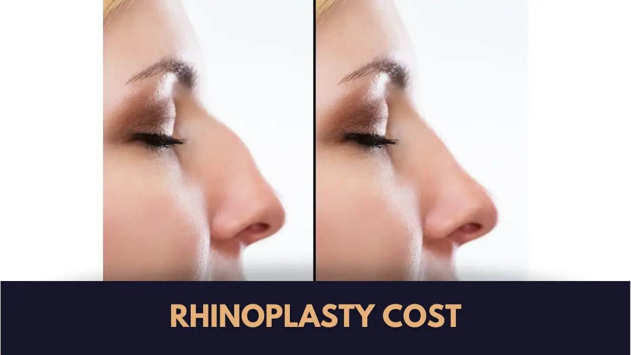 Rhinoplasty Cost in Pakistan