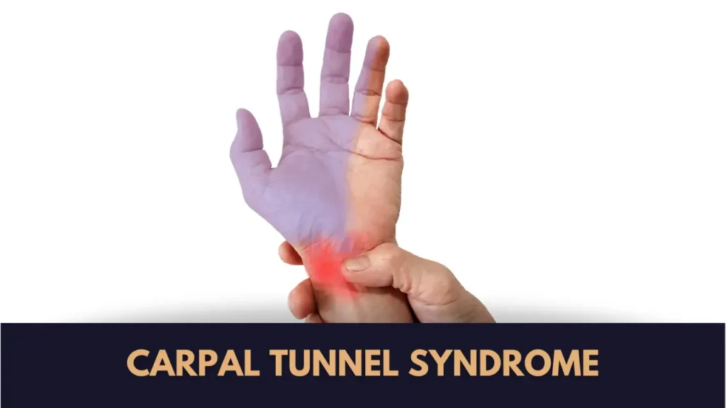 carpal tunnel syndrome surgery cost in pakistan