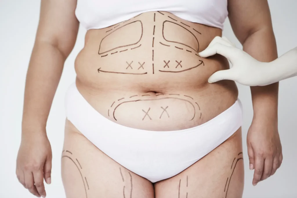 female body contouring lahore