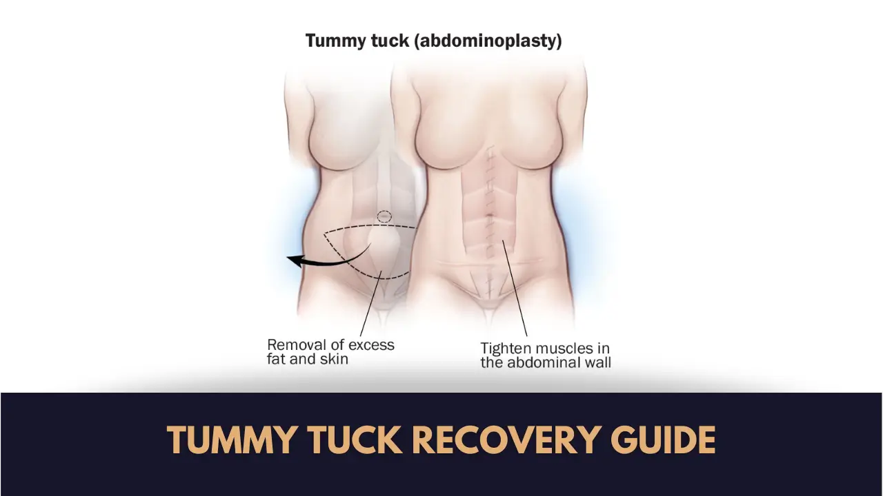 tummy tuck in lahore