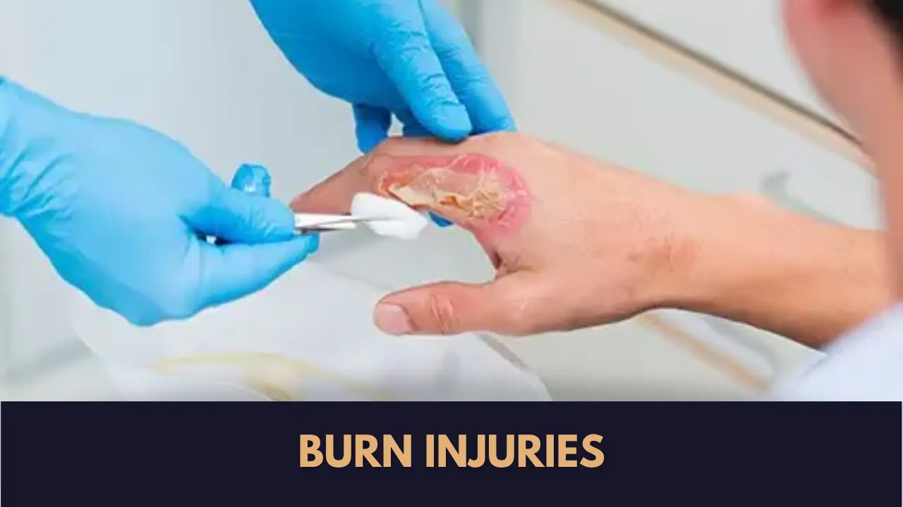 burn specialist in Lahore
