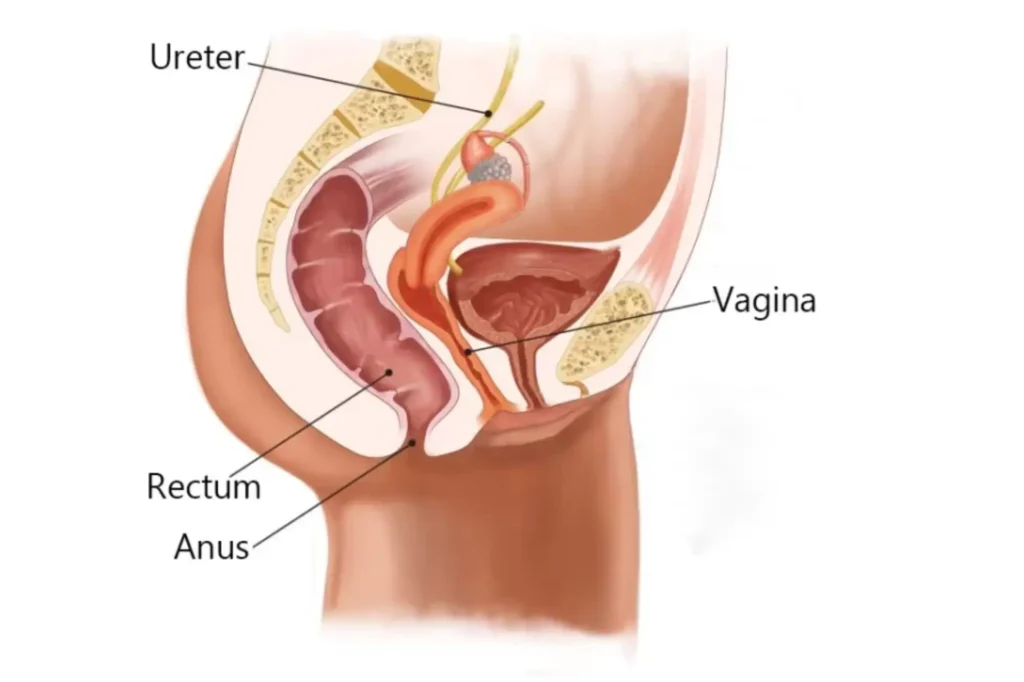 intimate rejuvenation surgery pakistan