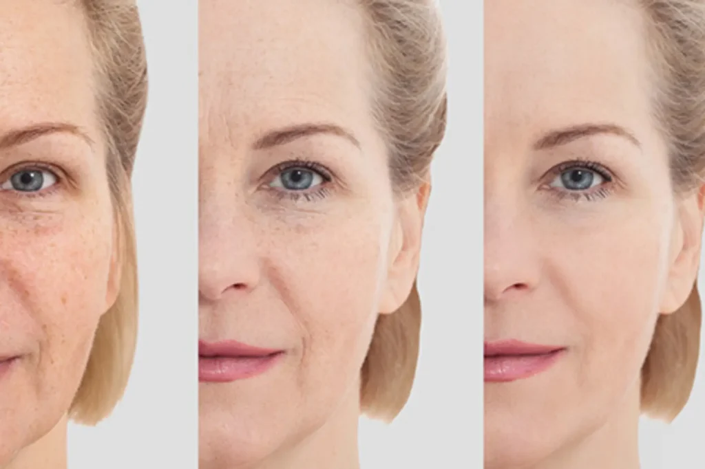 best facial rejuvenation lahore