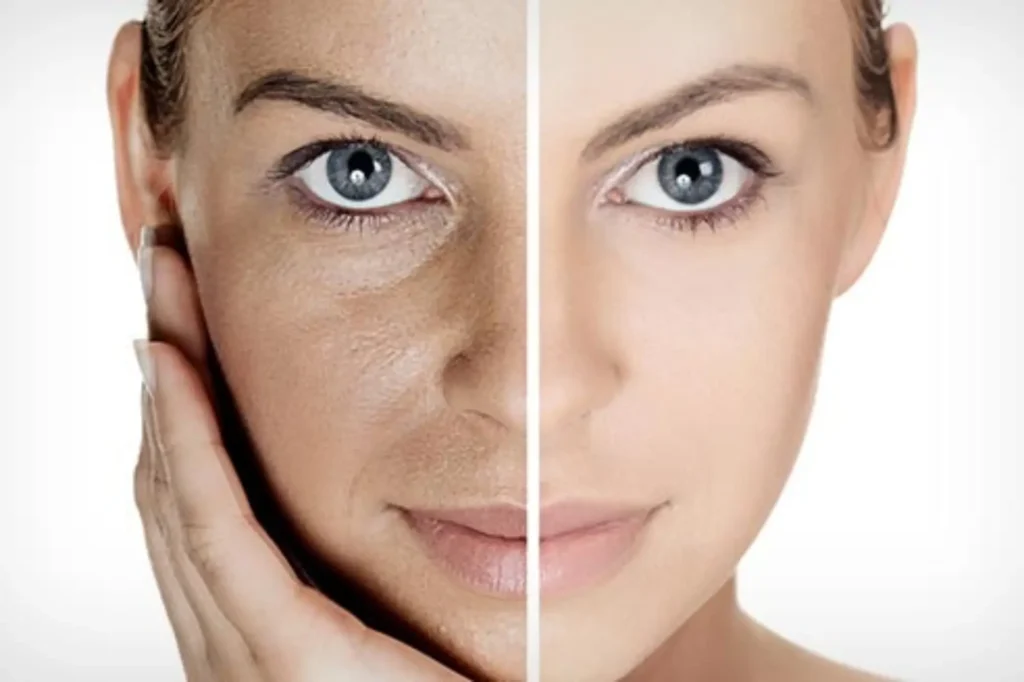 facial rejuvenation lahore