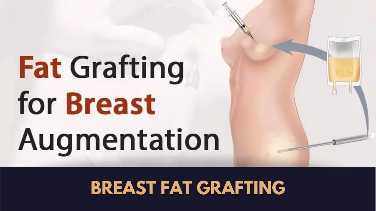 Breast Fat Grafting
