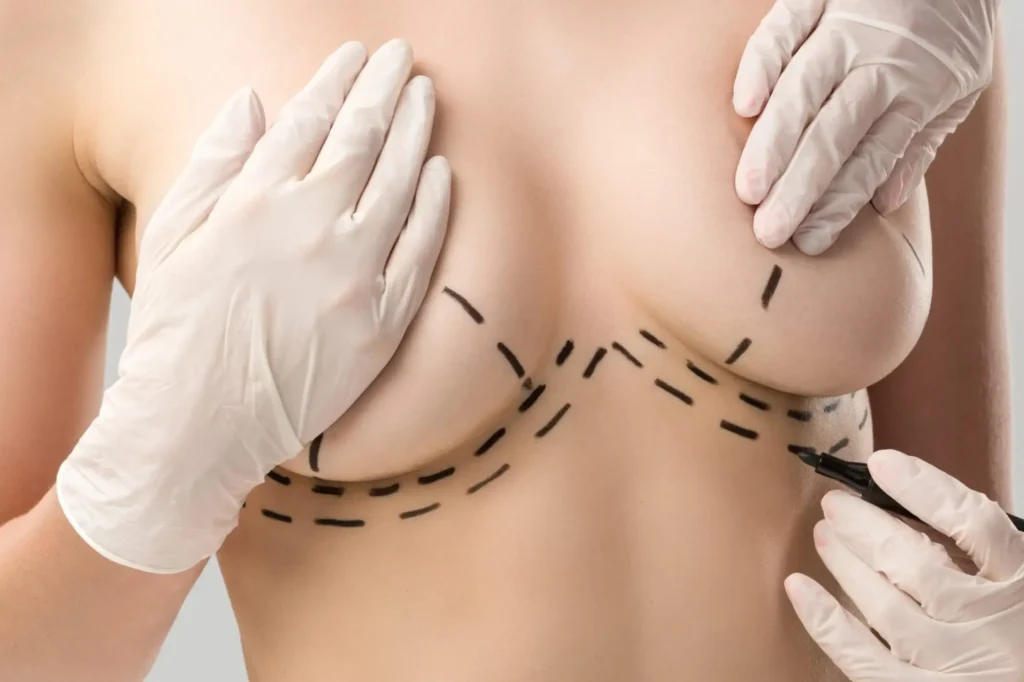 breast enlargement cost lahore