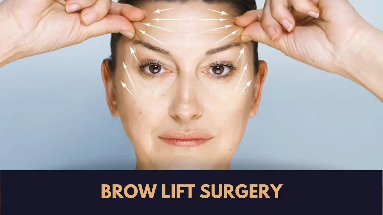 brow lift surgery
