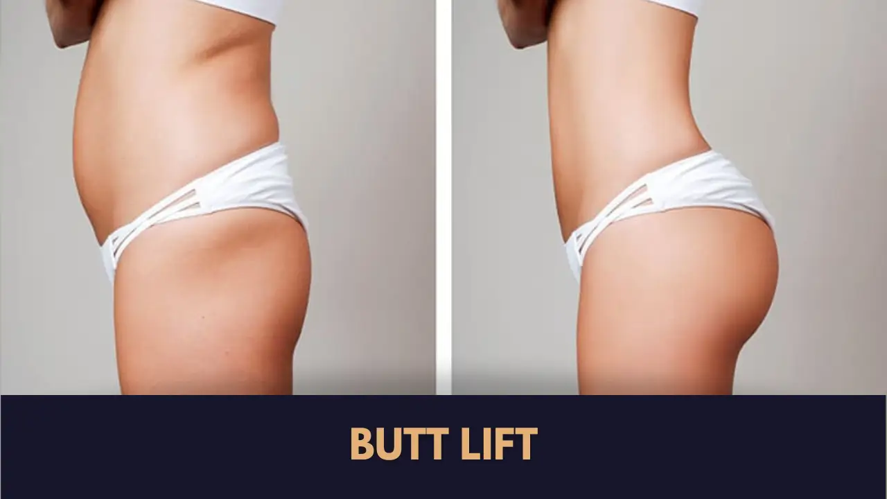 Butt Lift Surgery