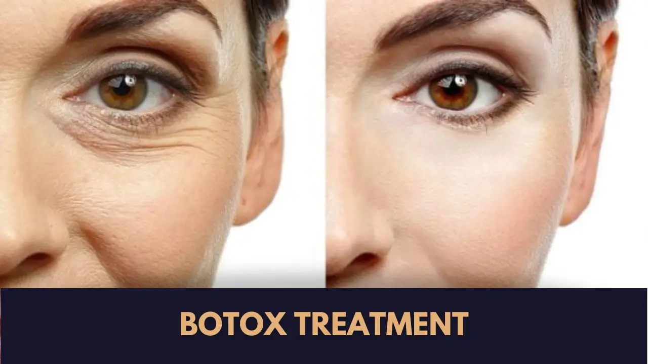 botox wrinkles treatment in lahore