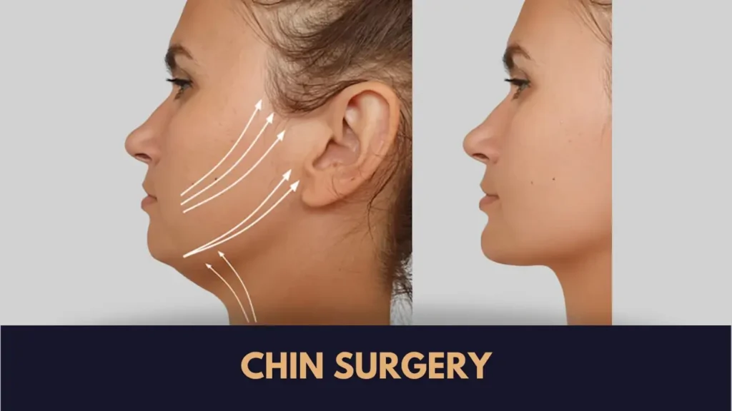 Chin Surgery Cost