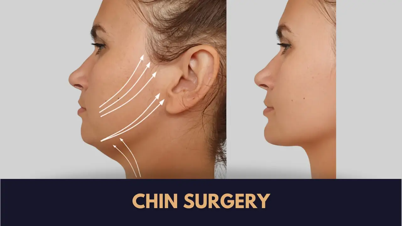 Chin Surgery Cost